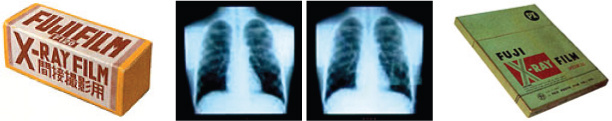 После изобретения рентгеновской пленки специалистами Fuji PhotoFilm медицинская флюорография стала привычным явлением