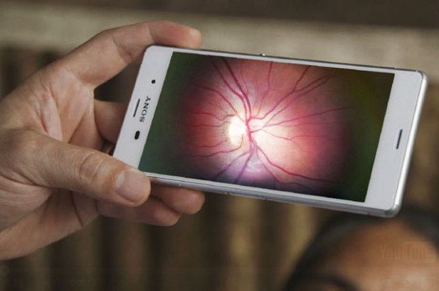 Адаптер и приложение превращают любой смартфон в офтальмологическую лабораторию
