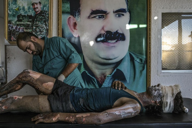 Номинация «Главные новости»: «Боевик ИГИЛ, проходящий лечение в курдском госпитале», Маурисио Лима (Бразилия). Снимок сделан для газеты New York Times. 2015 год.