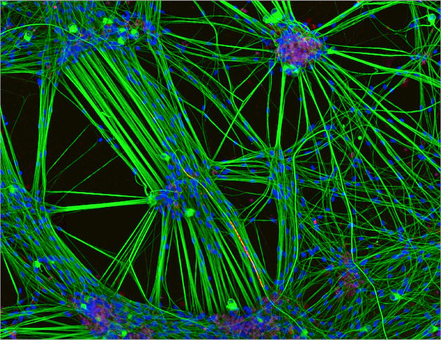 3 место
Клетки мозга (20-кратное увеличение)
2016 PHOTOMICROGRAPHY COMPETITION
Rebecca Nutbrown
University of Oxford
Nuffield Department of Clinical Neurosciences
Oxford, United Kingdom
