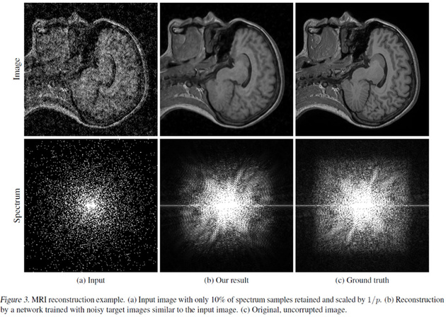 Рис. 3. Восстановленный МРТ-снимок. (a) Входное изображение с 10% зафиксированного спектра с масштабированием 1/p. (b) Восстановление с помощью нейросети, обученной на примере «шумных» изображений, близких ко входному изображению. (с) Референсное изображение. 