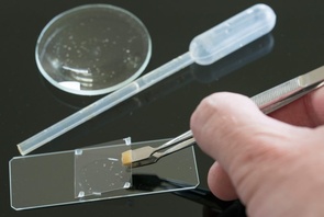 Вим ван Эгмонд использует вазелин, чтобы расположить объект съемки на предметном стекле