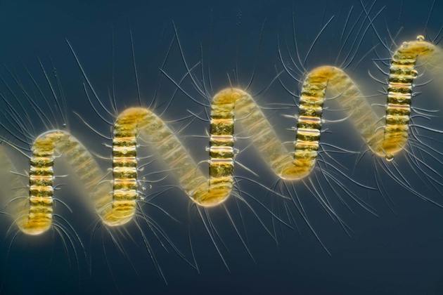 Вим ван Эгмонд, «Chaetoceros debilis (морские диатомовые водоросли), колониальный планктонный организм». 250-кратное увеличение. 1-е место конкурса Nikon Smal World в 2013 году.